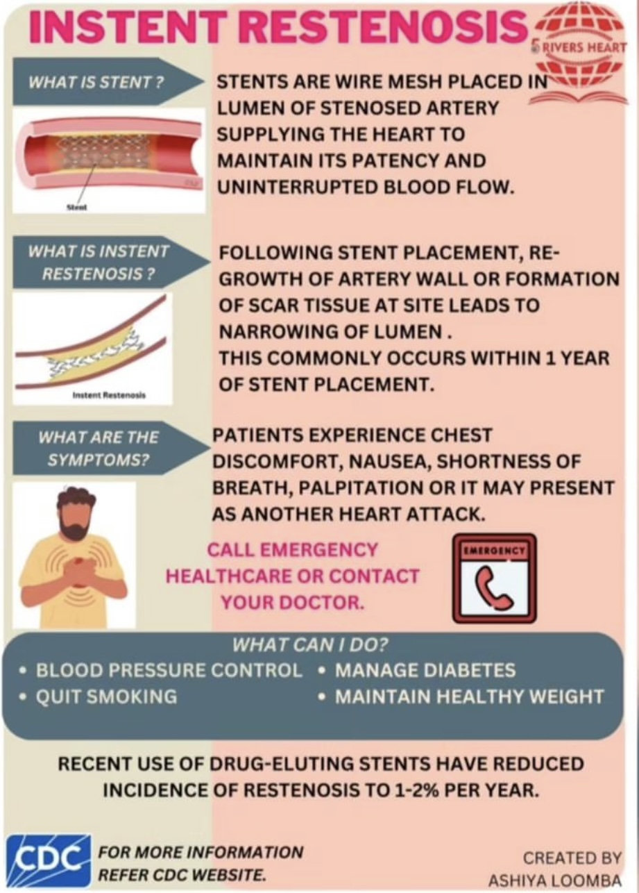 In-stent restenosis health poster in English